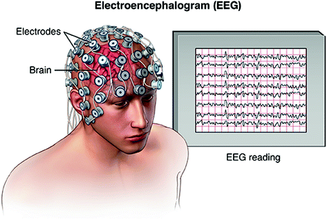 EEG